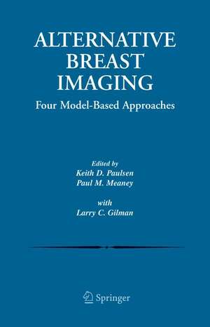 Alternative Breast Imaging: Four Model-Based Approaches de Keith D. Paulsen