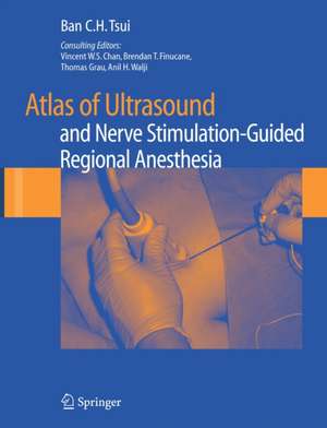 Atlas of Ultrasound- and Nerve Stimulation-Guided Regional Anesthesia de Ban C.H. Tsui