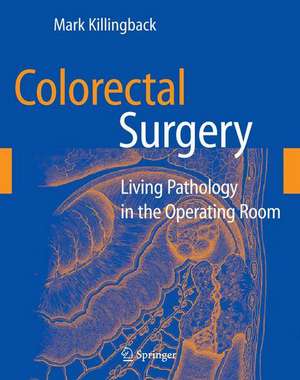 Colorectal Surgery: Living Pathology in the Operating Room de Mark Killingback