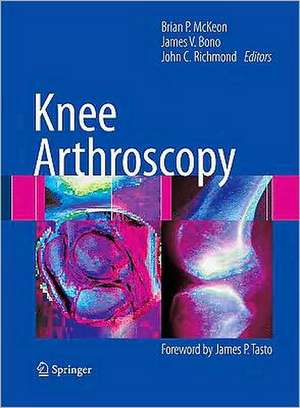 Knee Arthroscopy de Brian P. McKeon