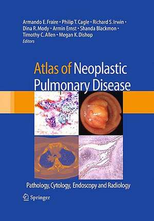 Atlas of Neoplastic Pulmonary Disease: Pathology, Cytology, Endoscopy and Radiology de Armando E. Fraire