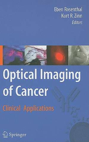 Optical Imaging of Cancer: Clinical Applications de Eben Rosenthal