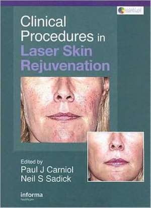 Clinical Procedures in Laser Skin Rejuvenation de Paul Carniol