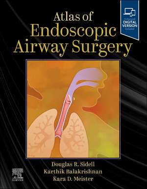 Atlas of Endoscopic Airway Surgery de Douglas R. Sidell