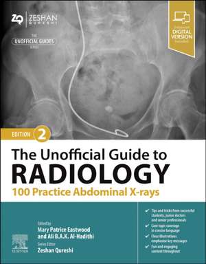 The Unofficial Guide to Radiology: 100 Practice Abdominal X-rays de Patrice Eastwood