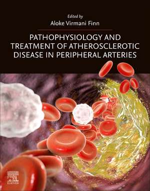 Pathophysiology and Treatment of Atherosclerotic Disease in Peripheral Arteries de Aloke Virmani Finn