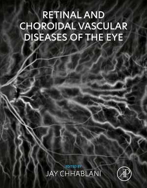 Retinal and Choroidal Vascular Diseases of the Eye de Jay Chhablani