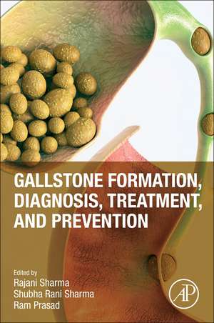 Gallstone Formation, Diagnosis, Treatment and Prevention de Rajani Sharma