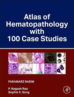 Atlas of Hematopathology with 100 Case Studies de Faramarz Naeim