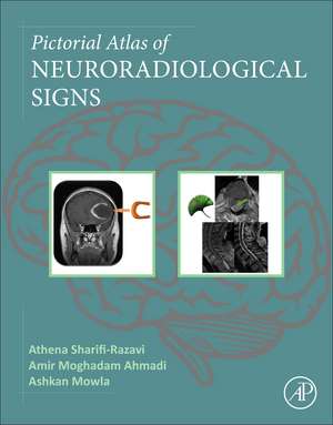 Pictorial Atlas of Neuroradiological Signs de Athena Sharifi-Razavi