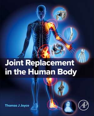 Joint Replacement in the Human Body de Thomas J Joyce