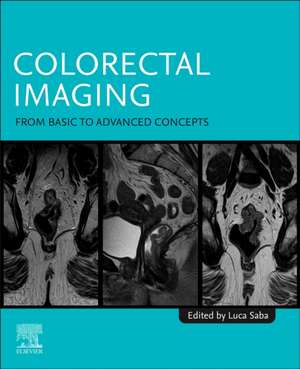 Colorectal Imaging: From Basic to Advanced Concepts de Luca Saba