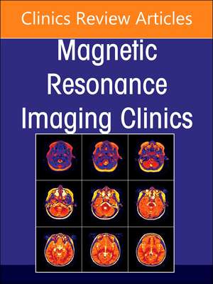 MR Imaging of the Hip, An Issue of Magnetic Resonance Imaging Clinics of North America de Jenny T. Bencardino