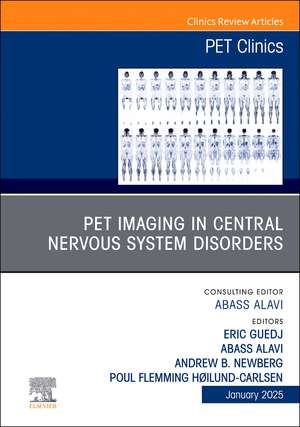 PET Imaging in Central Nervous System Disorders, An Issue of PET Clinics de Eric Guedj