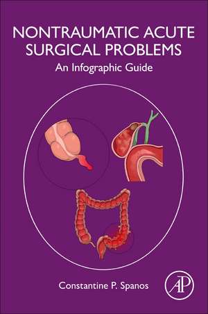 Non-Traumatic Acute Surgical Problems: An Infographic Guide de Constantine P. Spanos