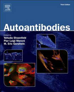 Autoantibodies de Yehuda Shoenfeld