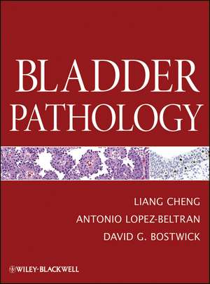 Bladder Pathology de L Cheng