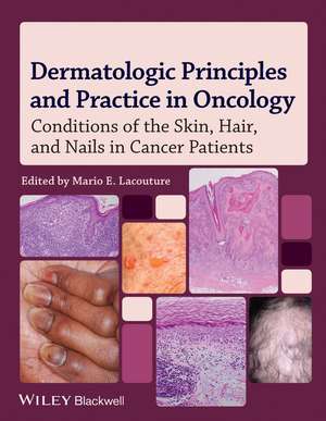 Dermatologic Principles and Practice in Oncology; Conditions of the Skin, Hair, and Nails in Cancer Patients de ME Lacouture