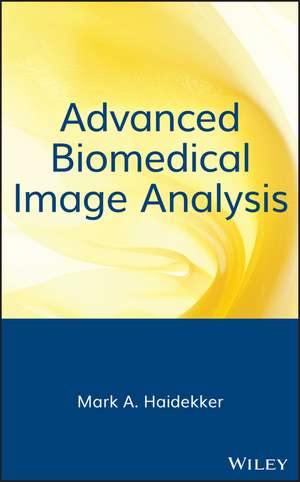 Advanced Biomedical Image Analysis w/DVD de M Haidekker