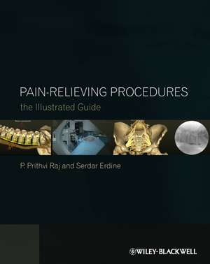 Pain-Relieving Procedures de P Prithvi Raj