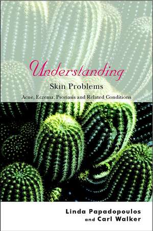 Understanding Skin Problems – Acne, Eczema, Psoriasis and Related Conditions de L Papadopoulos