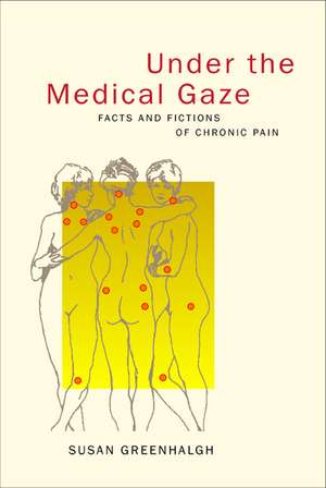 Under the Medical Gaze – Facts & Fictions of Chronic Pain de Susan Greenhalgh