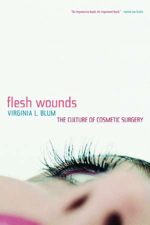 Flesh Wounds – The Culture of Cosmetic Surgery de Virginia L Blum