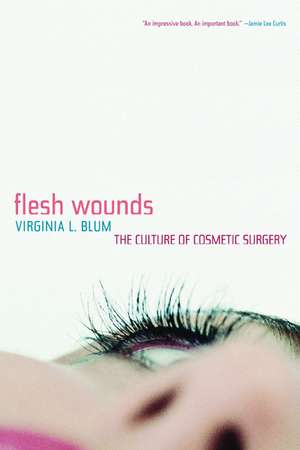 Flesh Wounds de Virginia Blum