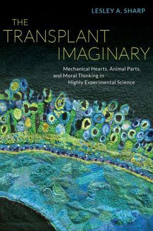 Sharp, L: Transplant Imaginary