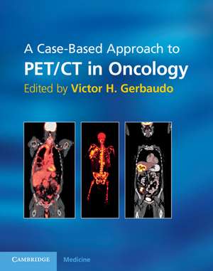 A Case-Based Approach to PET/CT in Oncology de Victor H. Gerbaudo PhD