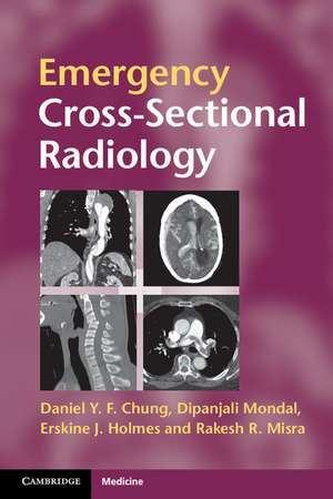 Emergency Cross-sectional Radiology de Daniel Y. F. Chung