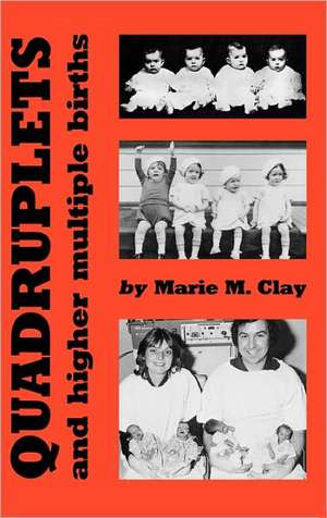 Quadruplets and Higher Multiple Births de Marie M. Clay