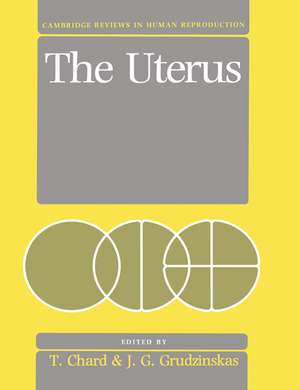 The Uterus de T. Chard