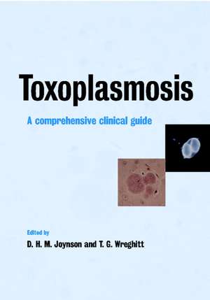 Toxoplasmosis: A Comprehensive Clinical Guide de David H. M. Joynson