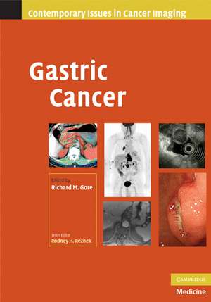 Gastric Cancer de Richard M. Gore