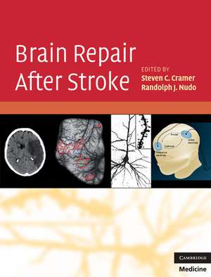 Brain Repair After Stroke de Steven C. Cramer MD