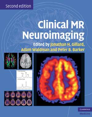 Clinical MR Neuroimaging: Physiological and Functional Techniques de Jonathan H. Gillard