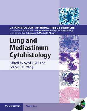 Lung and Mediastinum Cytohistology with CD-ROM de Syed Z. Ali M.D.