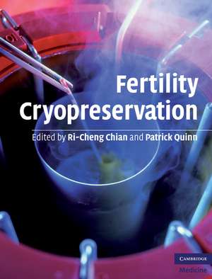 Fertility Cryopreservation de Ri-Cheng Chian