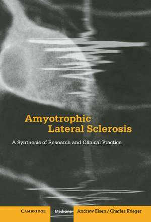 Amyotrophic Lateral Sclerosis: A Synthesis of Research and Clinical Practice de Andrew Eisen