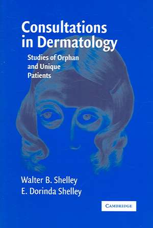 Consultations in Dermatology: Studies of Orphan and Unique Patients de Walter B. Shelley