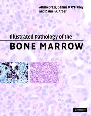 Illustrated Pathology of the Bone Marrow de Attilio Orazi