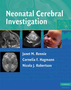 Neonatal Cerebral Investigation de Janet M. Rennie