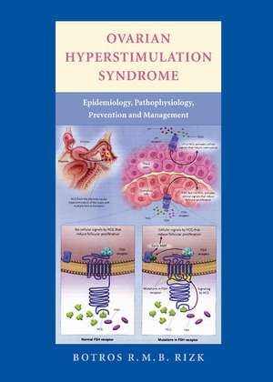 Ovarian Hyperstimulation Syndrome: Epidemiology, Pathophysiology, Prevention and Management de Botros Rizk