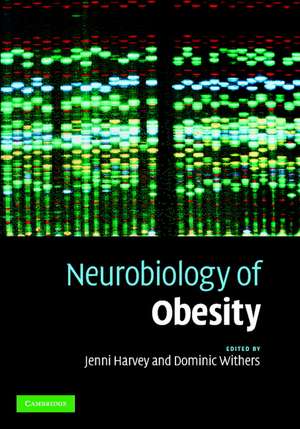 Neurobiology of Obesity de Jenni Harvey