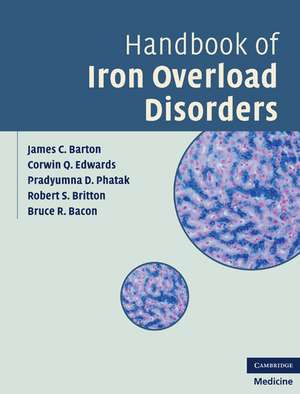 Handbook of Iron Overload Disorders de James C. Barton