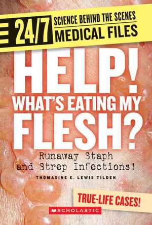 Help! Whats Eating My Flesh?: Runaway Staph and Strep Infections! de Thomasine E. Lewis Tilden