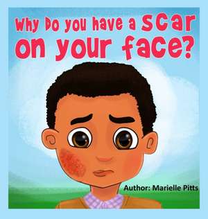 Why do you have a scar on your face? de Marielle Pitts