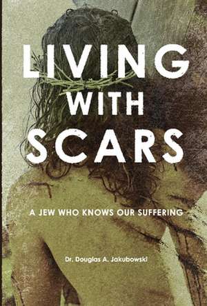 Living with Scars: A Jew Who Knows Our Suffering de Douglas Jakubowski