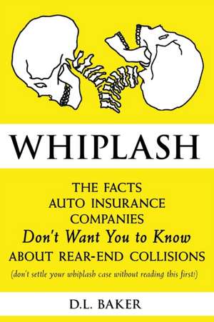 Whiplash: The Facts Auto Insurance Companies Don't Want You to Know About Rear-End Collisions de D. L. Baker